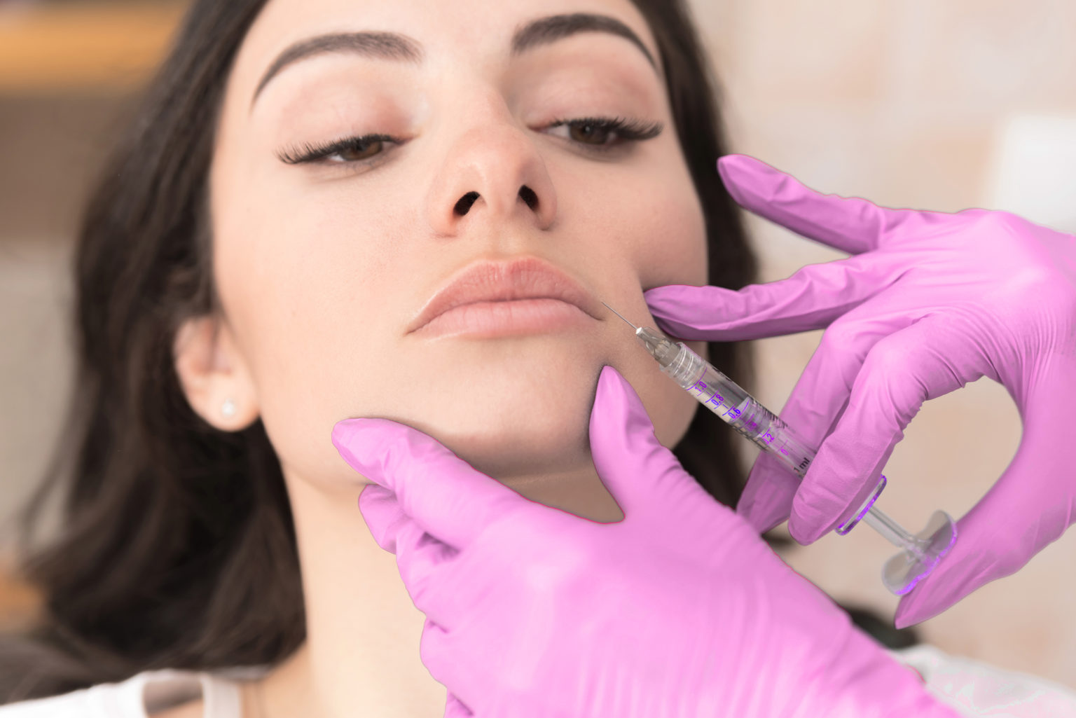 Lip Filler | BLOOM HEALTH — Top Rated Injectors in Metro Detroit